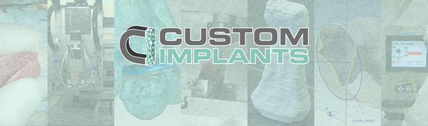 Custom Implants - Progettazione e realizzazione di tessuti e endoprotesi su misura  mediante tecnologie sottrattive e additive